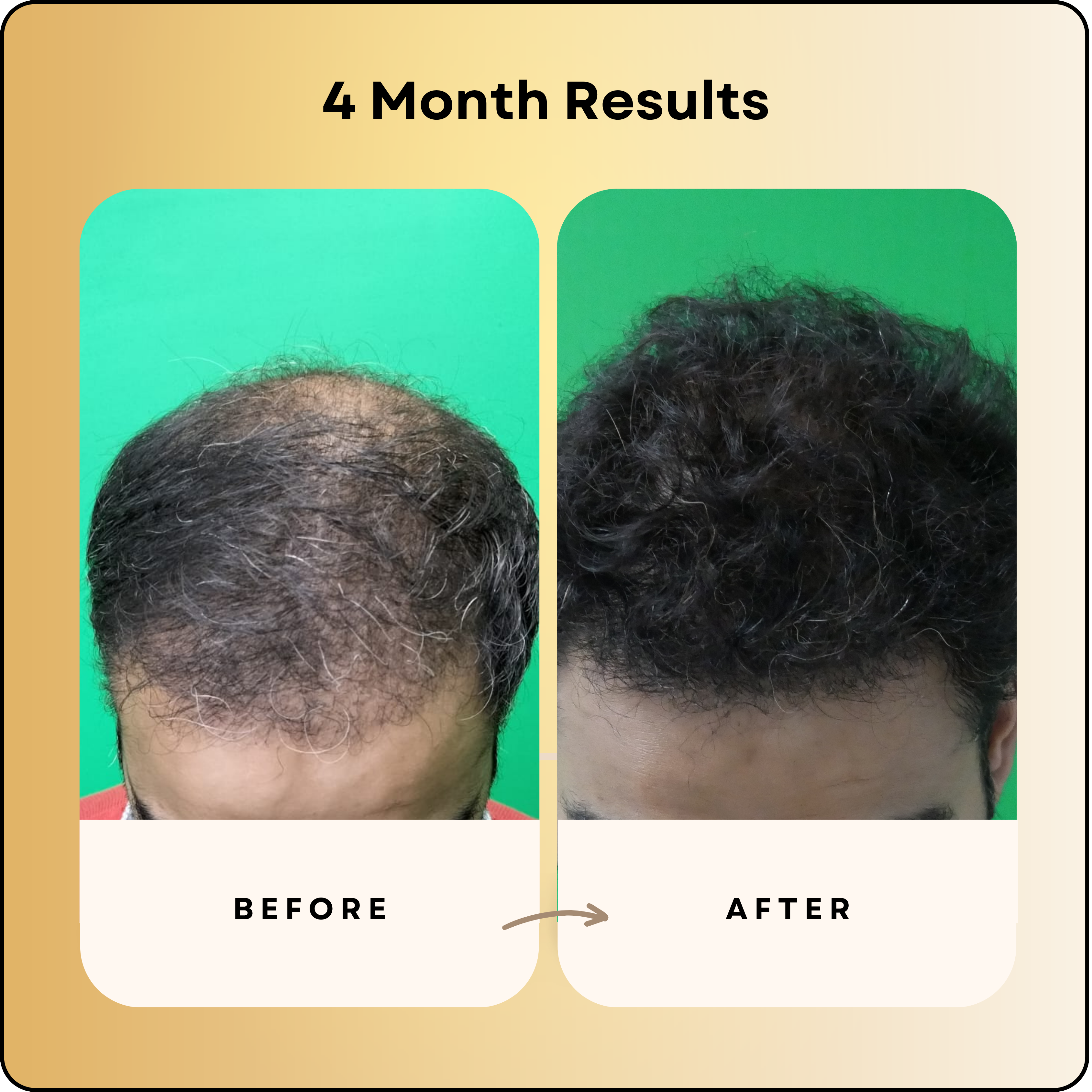 Hair Growth Serum