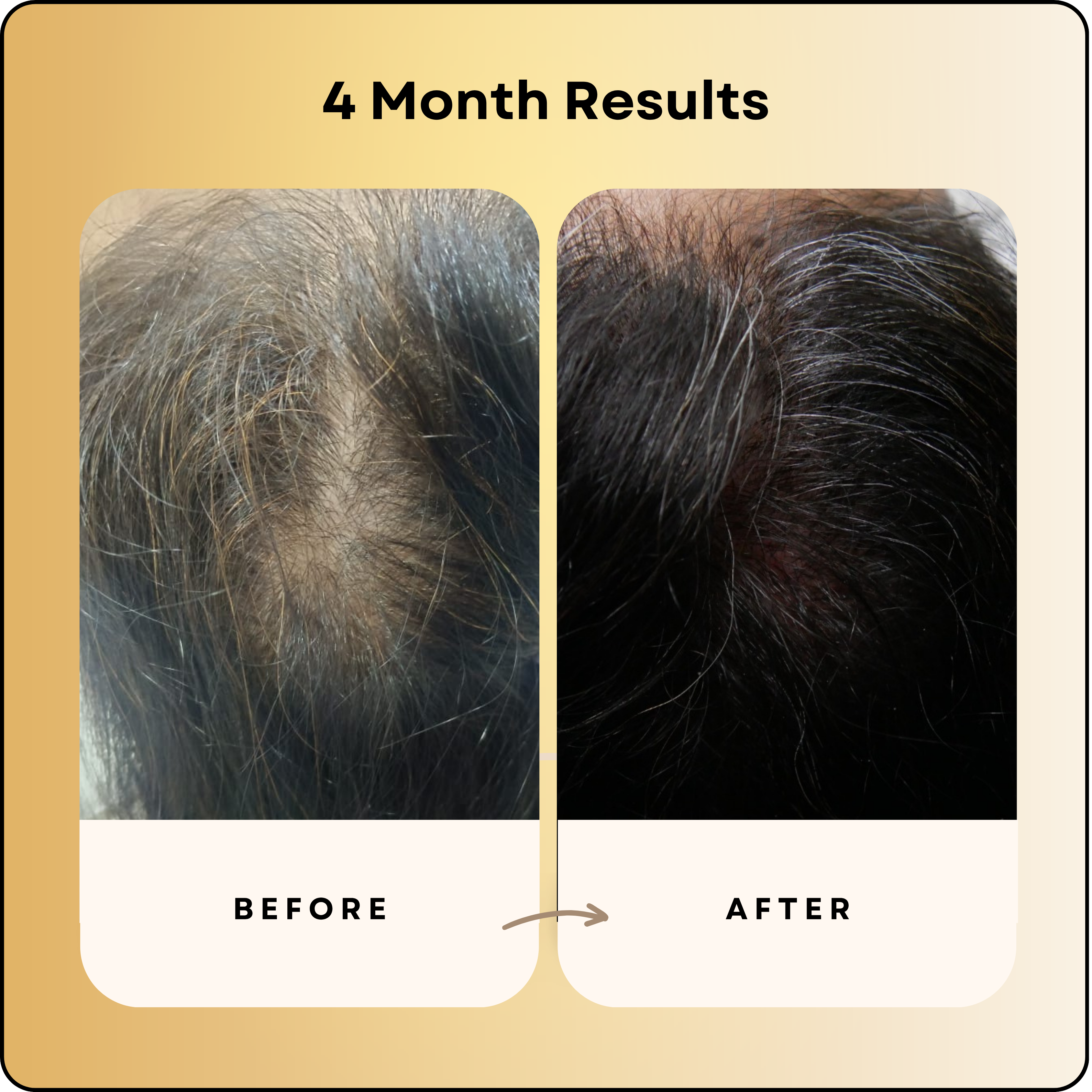 Hair Growth Serum